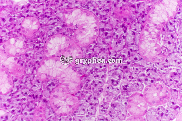 Parathyroïde x100 - gryphea.com